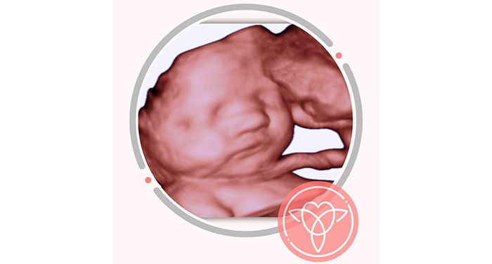 Ecografía ecolatido/5D. Envío de todas las fotos y 1 Impresión de la foto favorita