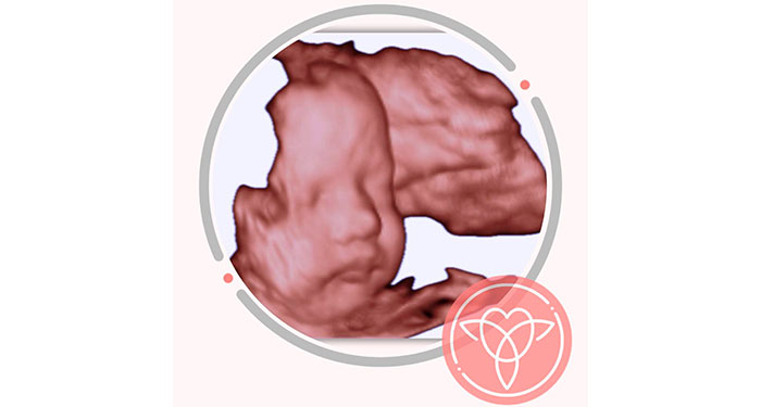 Ecografía ecolatido/5D. Envío de todas las fotos y 1 Impresión de la foto favorita