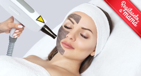 ¡Regalazo! Rejuvenece el rostro con 1, 2 o 3 Sesiones de Láser Carbon Peel Facial