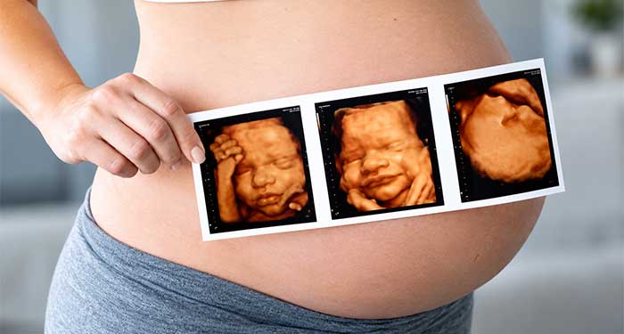 Ecografía en 5D con latido, foto en 5D y foto digital personalizada, peso y medida